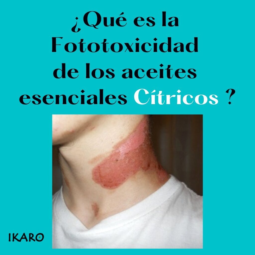 ¿Qué es la Fototoxicidad de los aceites esenciales?