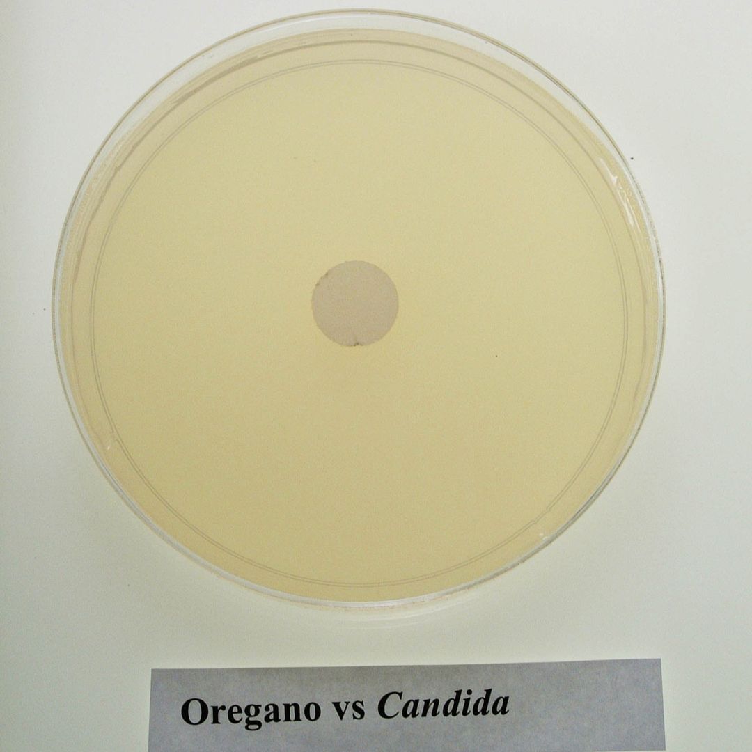 aceites esenciales y candidiasis - aceite de orégano, clavo y tomillo para eliminar candida albicans